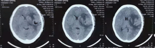 3.gif
