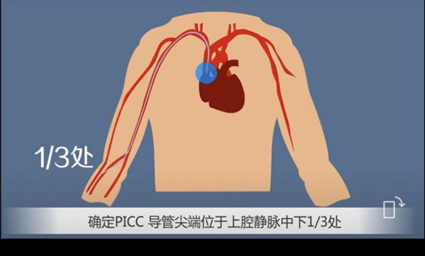 微信图片_20230522074647.jpg 微信图片_20230522074647.jpg