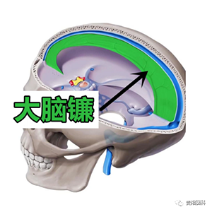 22.png 22.png