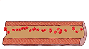 6.gif