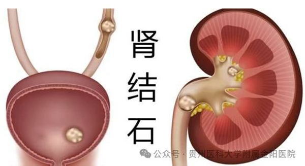 微信图片_20240315094634.jpg 微信图片_20240315094634.jpg