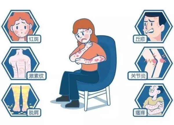 图片 1.png