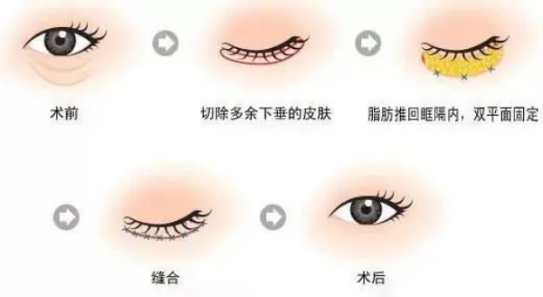 图片 14.png
