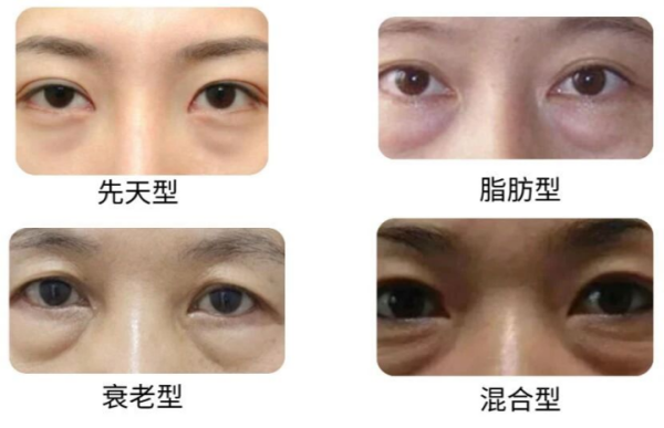 图片 15.png