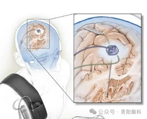 微信图片_20240704080148.png 微信图片_20240704080148.png